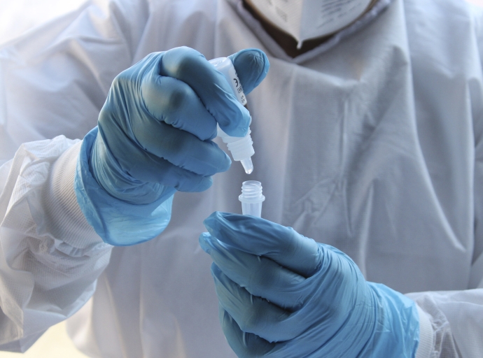 Salud: 348 nuevos contagios de SARS-CoV-2 en las últimas 96 horas