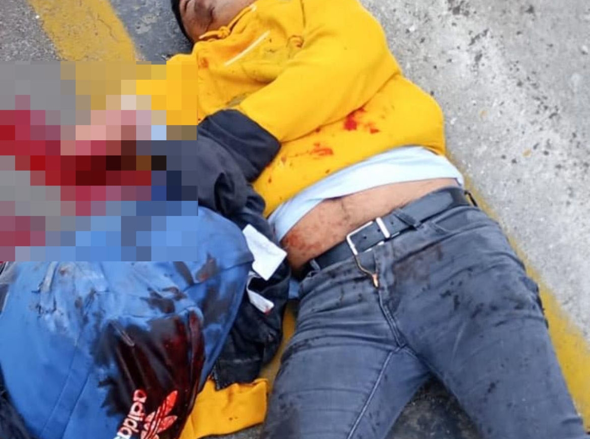 Hombre pierde un brazo en accidente de motocicleta en la autopista México-Puebla