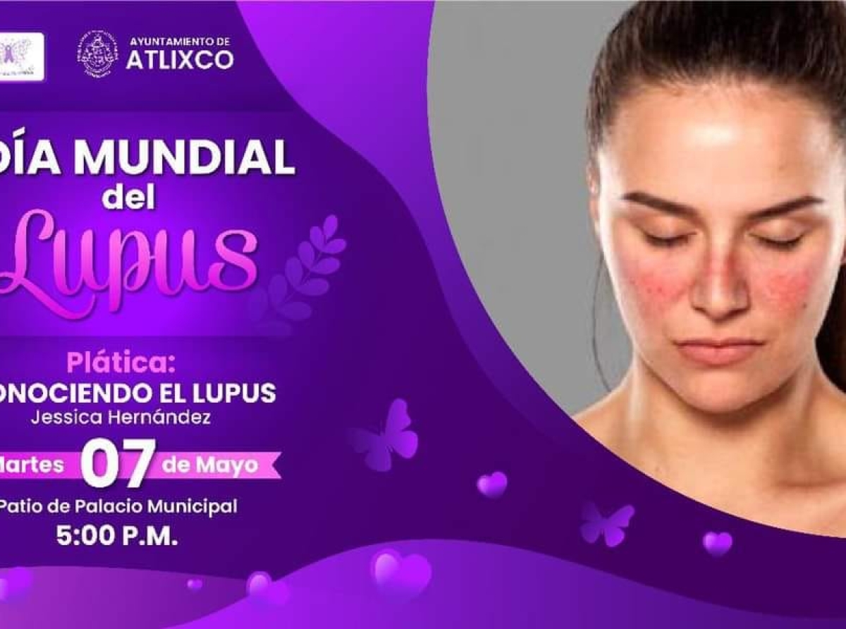 Con diferentes actividades conciencian sobre el lupus en Atlixco